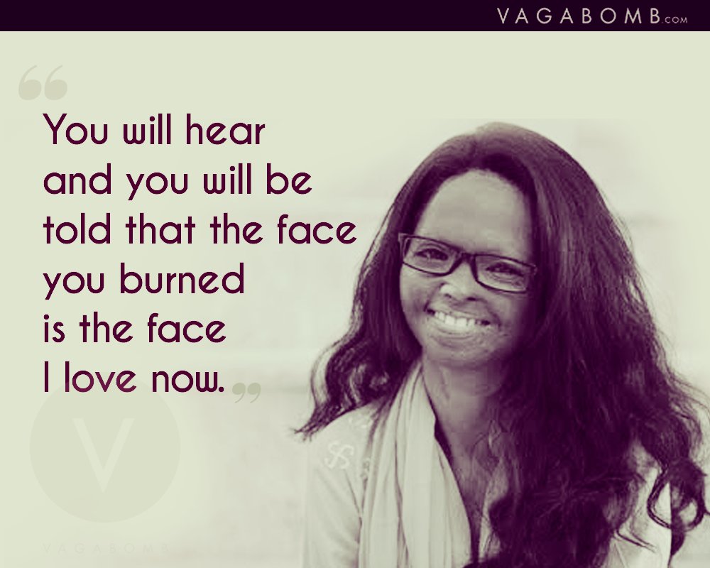10 Quotes by Acid Attack Survivor Laxmi Agarwal That Show Her