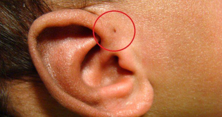 10 Fascinating & Incredibly Rare Body Features You ... ear piercing diagram 