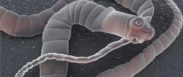 10 Most Dangerous Worms & Parasites That Can Live Inside You And Do