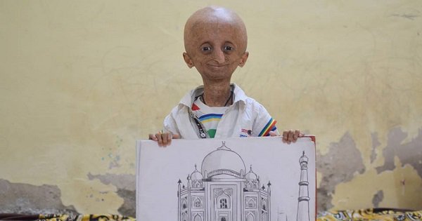 more-power-to-him-progeria-patient-nihal-bitla-has-a-rare-inspiring