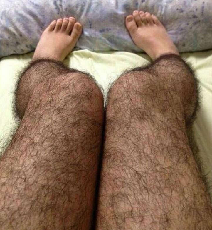 And how can we forget 'the hairy legs'? 