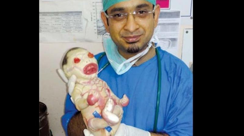 India's First 'Harlequin Baby' Born In A Farmer's Family ...